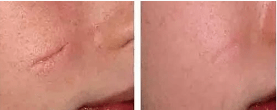 City Integrative Rehabilitation clinic in Manhattan offering scar tissue release and shockwave therapy