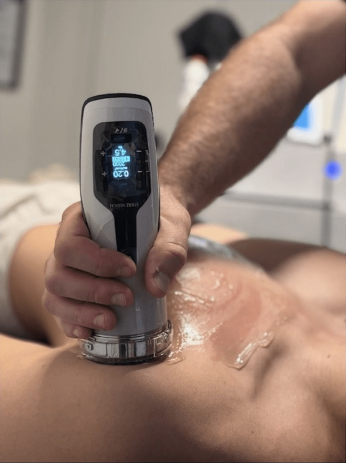 Focused shockwave therapy treatment for bicipital tendinitis