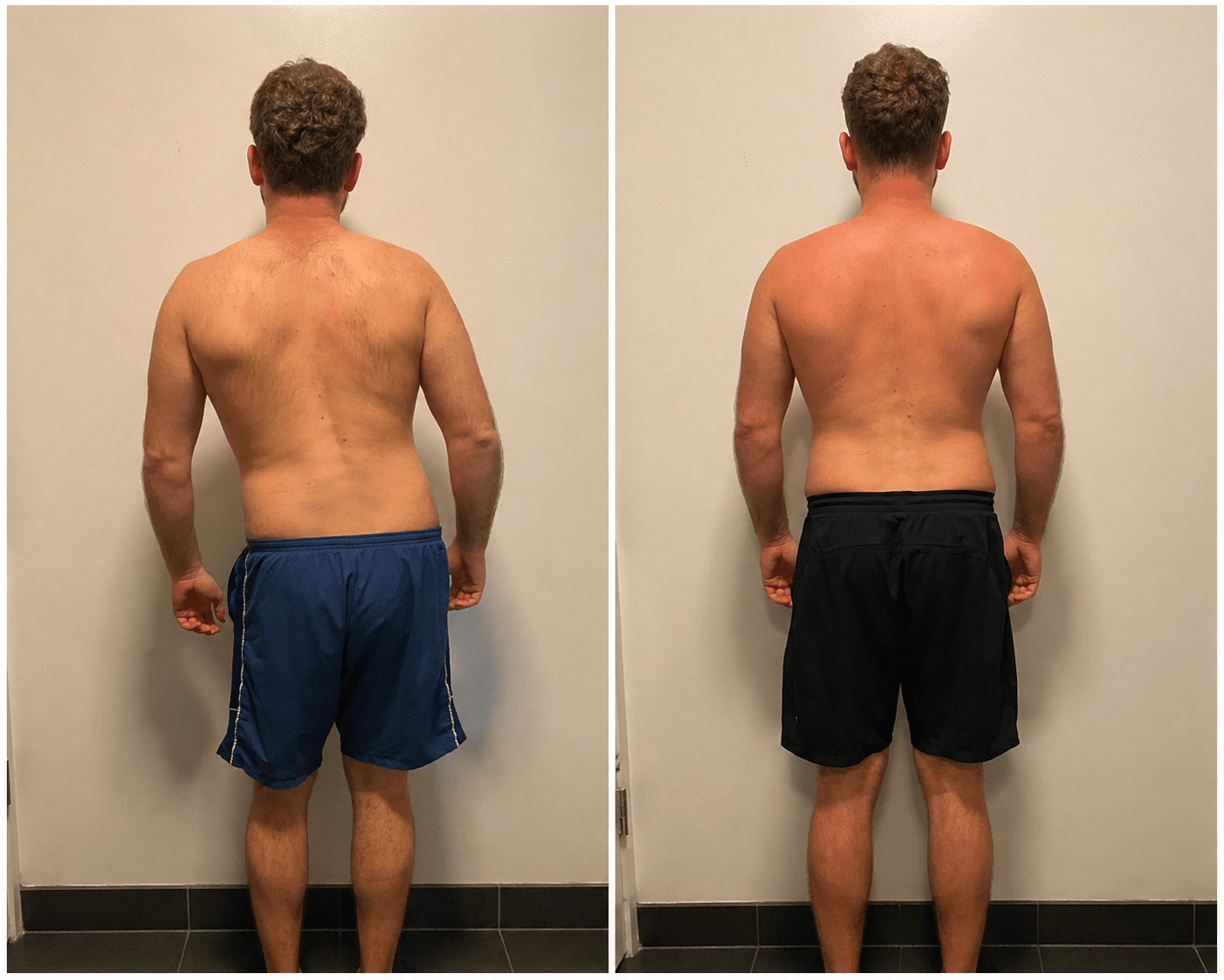 Before and after &mdash; full-body postural alignment at CityIR