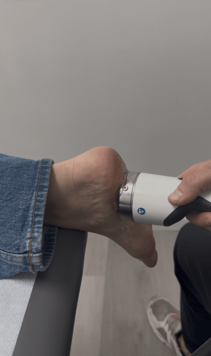 Shockwave therapy treatment for plantar fasciitis